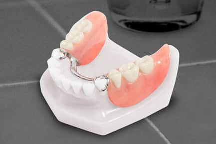 Smile gallery | best Dental clinic in undri 411060